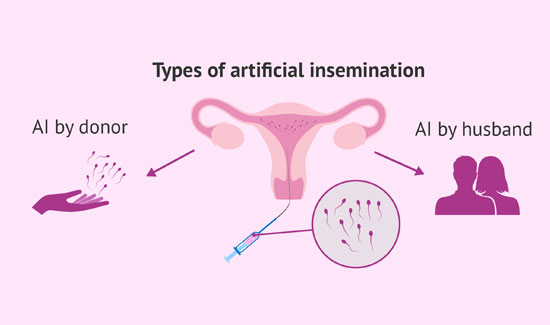 Infertility Clinic in Bangalore