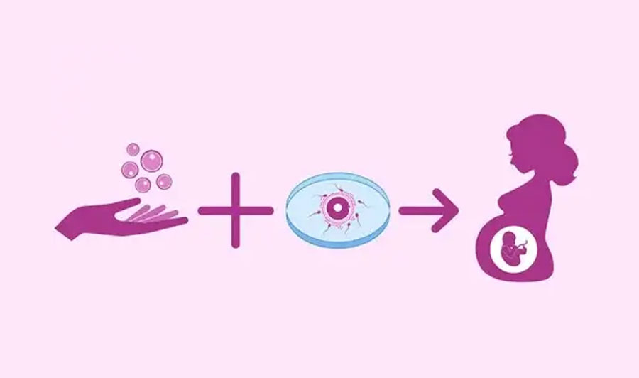 Egg Donation Services at Miracle IVF Hospital, Bangalore.