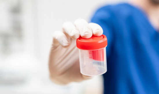 Semen Analysis in Bangalore at Miracle Ivf Hospital 